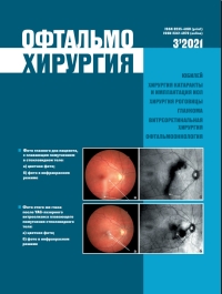 					Показать № 3 (2021): Офтальмохирургия
				