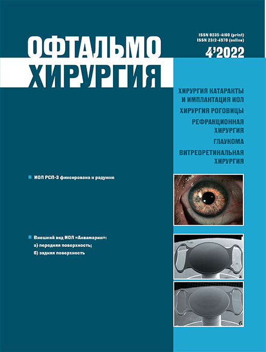 					Показать № 4 (2022): Офтальмохирургия
				